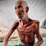 المسمار الإلكتروني | الحرب في غزة: جوع يسابق الرصاص