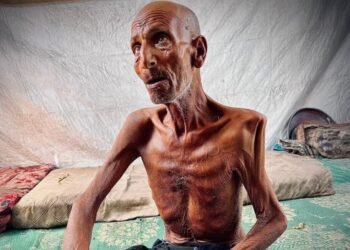 المسمار الإلكتروني | الحرب في غزة: جوع يسابق الرصاص