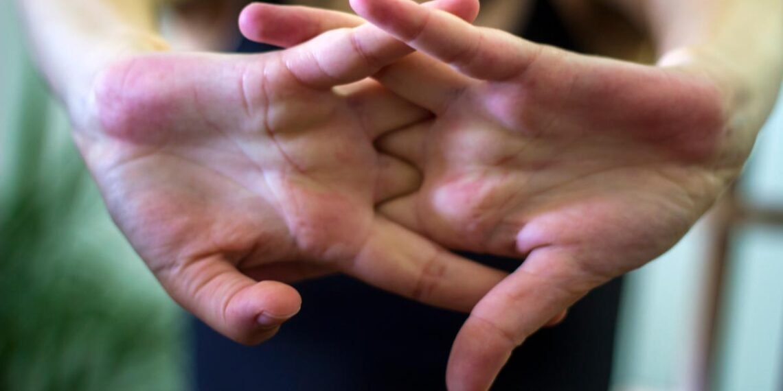 المسمار الإلكتروني | تحذير من طقطقة المفاصل: أضرار صحية قد تؤدي إلى جراحة