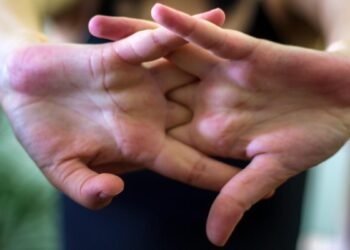 المسمار الإلكتروني | تحذير من طقطقة المفاصل: أضرار صحية قد تؤدي إلى جراحة