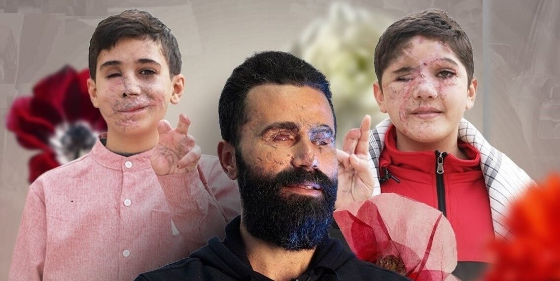 جريمة البيجر.. صدى الفاجعة عبر الأجيال، بقلم ليليان حمزة