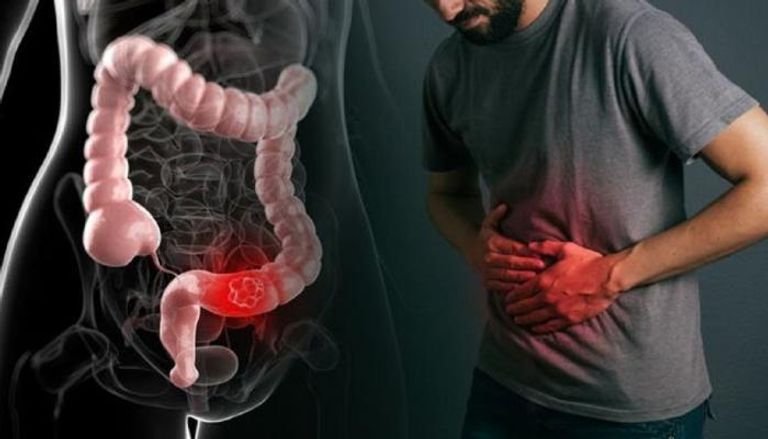 المسمار الإلكتروني | الإمساك ليس مجرد اضطراب هضمي… بل لغة يخاطب بها الجسد نفسه، الرؤية العلاجية للدكتورة ماريا قبيسي